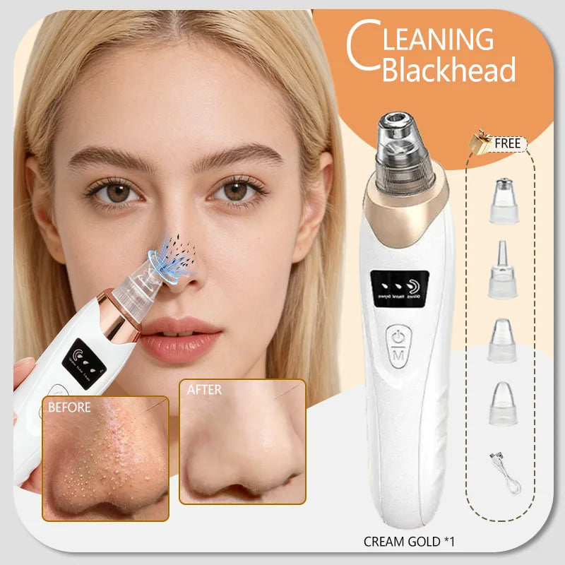 Rechargeable Blackhead Vacuum Pore Extractor