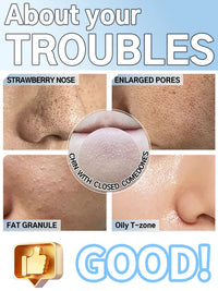 Rechargeable Blackhead Vacuum Pore Extractor