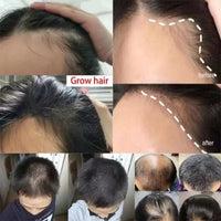 Fast Ginger Hair Growth Spray Roots Grow Anti Hair Loss Hair Regrowth Serum Scalp Damaged Repair Nourish Care Products Women Men