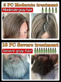 Gray Hair Darkening Treatment Serum