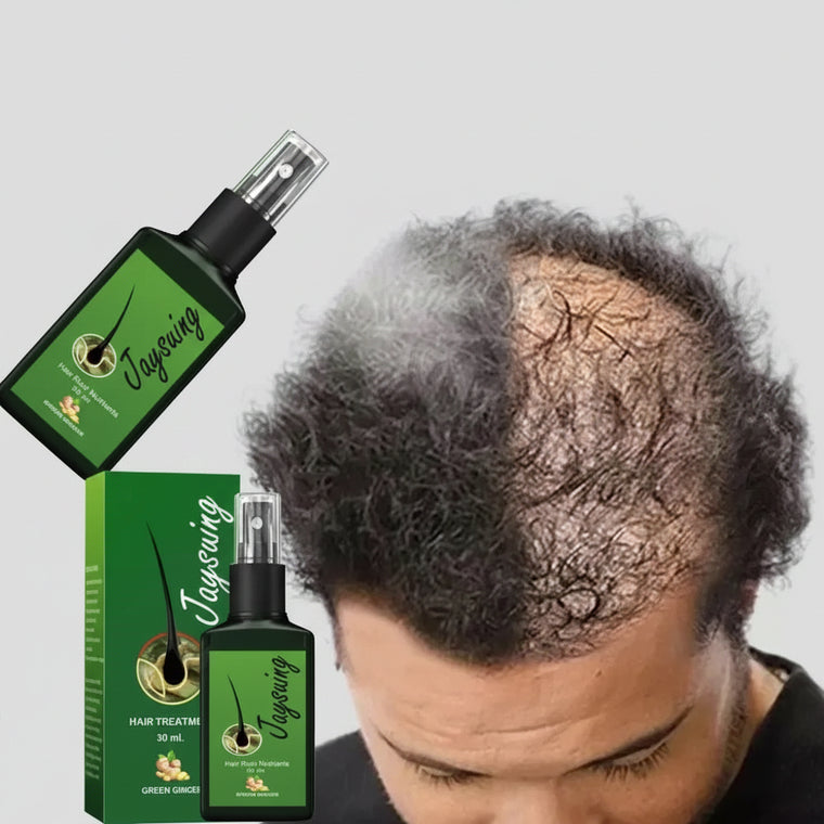 Fast Ginger Hair Growth Spray Roots Grow Anti Hair Loss Hair Regrowth Serum Scalp Damaged Repair Nourish Care Products Women Men