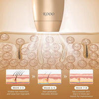 KODO Ice Cooling IPL Epilator