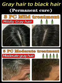 Gray Hair Darkening Treatment Serum
