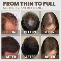 Adglamful Hair Fiber Powder 30g- Instant Thickening, Dense Hair, Wind/Sweat-Proof, 24H Hold, for Thin Hair