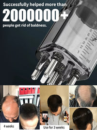 Scalp Oil Applicator Massage Comb