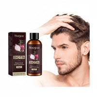 Red Onion Shampoo Rosemary Hair Growth Soft Shine Hydrating Stronger Hair Root Cleansing Scalp Refreshing Biotin Infused Shampoo