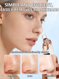 Rechargeable Blackhead Vacuum Pore Extractor