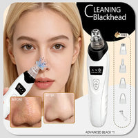 Rechargeable Blackhead Vacuum Pore Extractor